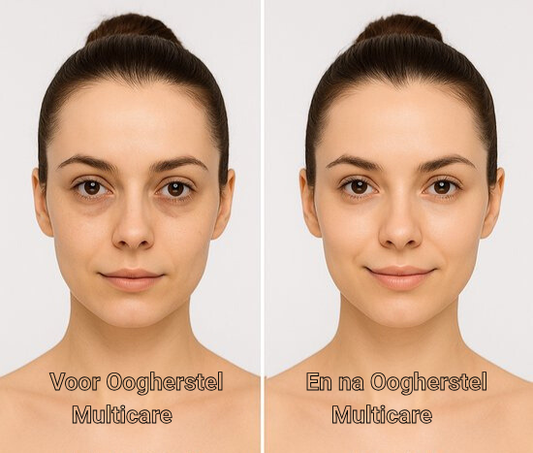 Oogherstel MultiCare by Hometura